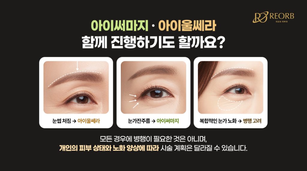 나에게 맞는 눈가 리프팅 방법은?