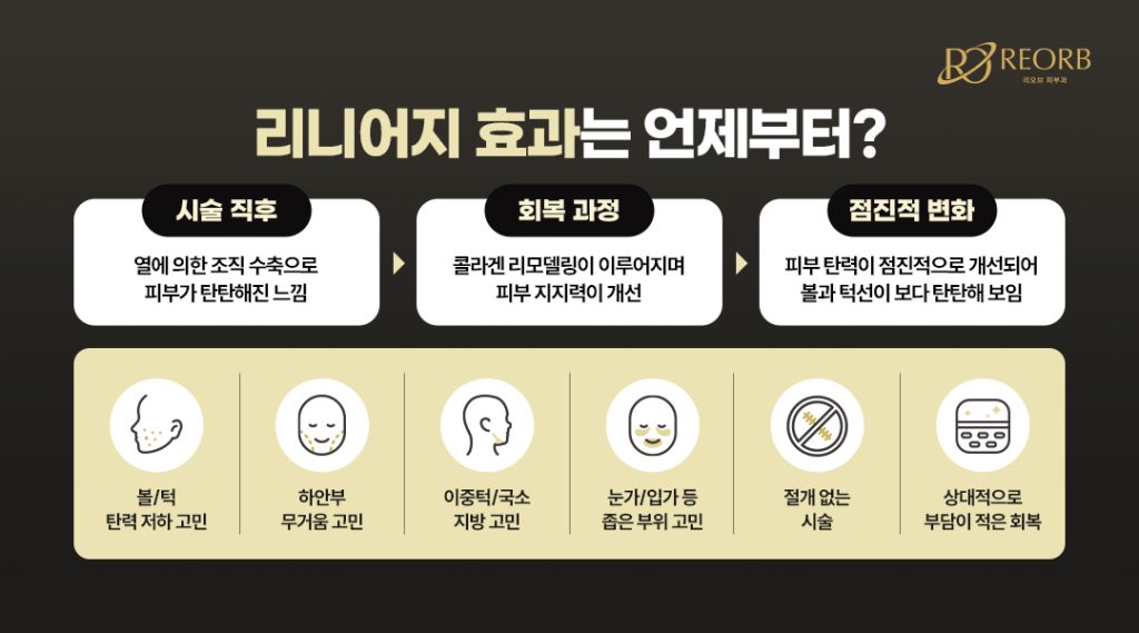 리니어지리프팅 효과