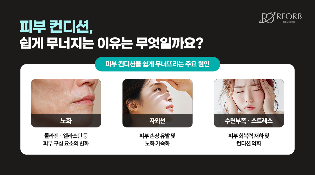 피부 컨디션이 저하되는 이유에 대해 설명한 이미지