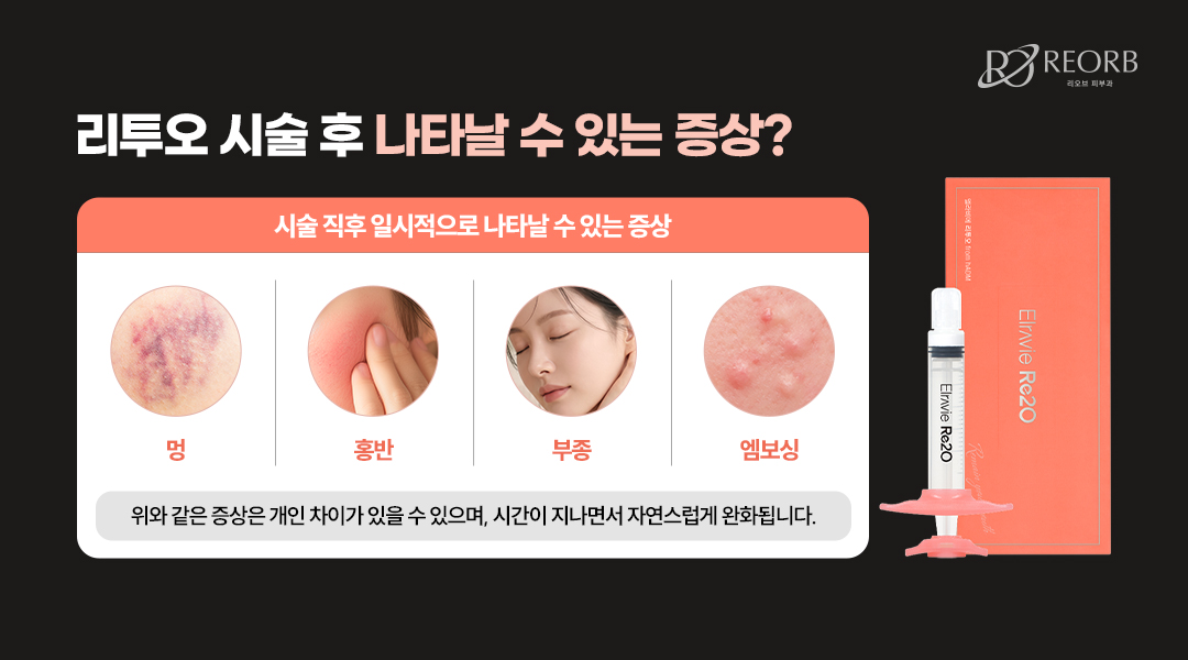 리투오 시술 후 나타날 수 있는 증상에 대해 설명한 이미지