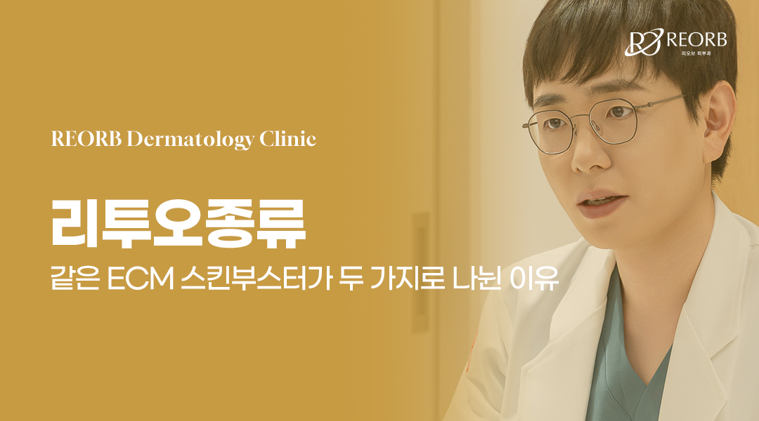 리투오와 리투오 파인에 대해 설명하는 글의 썸네일