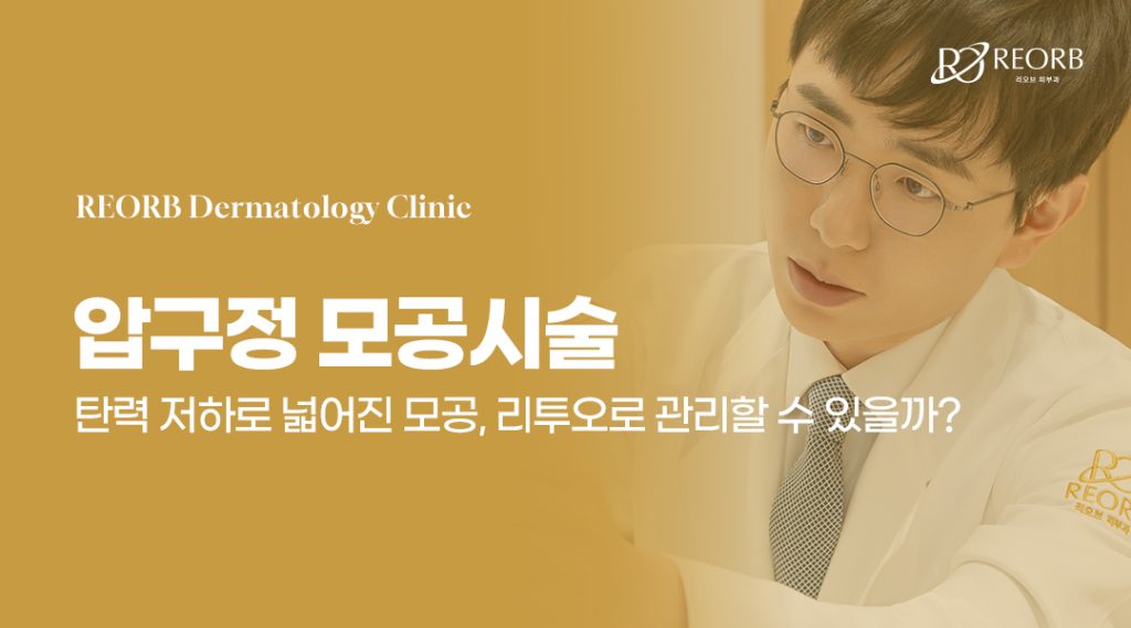 압구정모공시술로 많이 활용되는 리투오에 대해 설명한 글의 썸네일