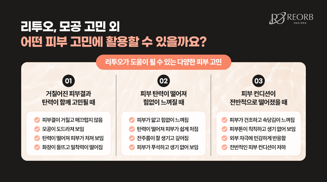 모공 외에 활용할 수 있는 리투오 특징에 대한 이미지