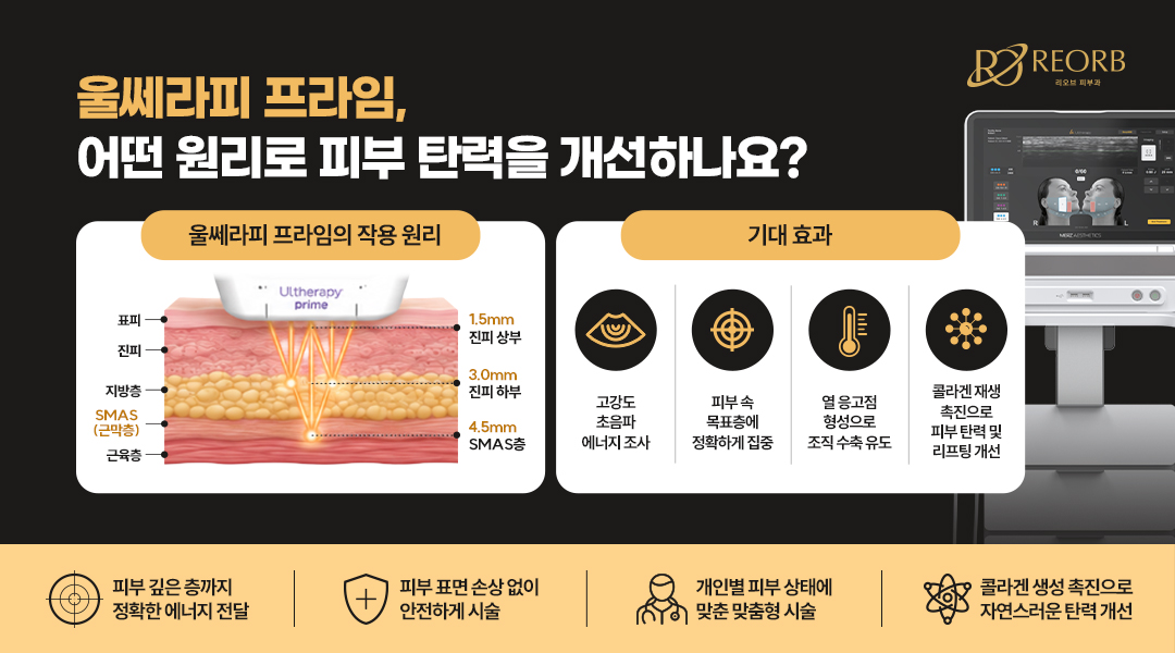 울쎄라 원리에 대해 설명한 이미지