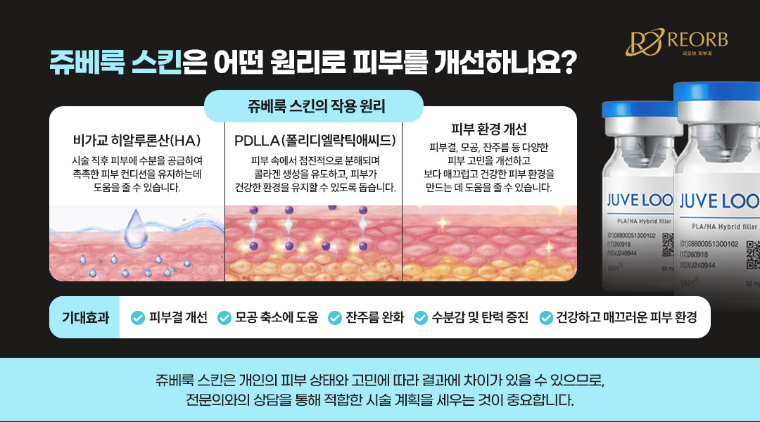 쥬베룩스킨의 원리에 대해 설명한 이미지