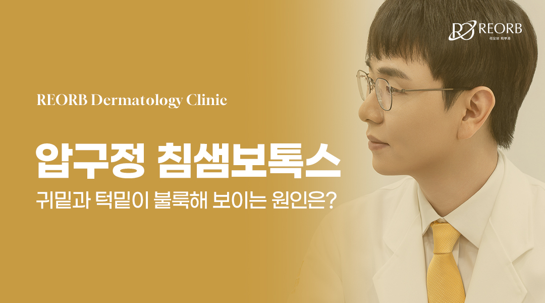 침샘보톡스에 대한 특징을 설명한 글의 썸네일