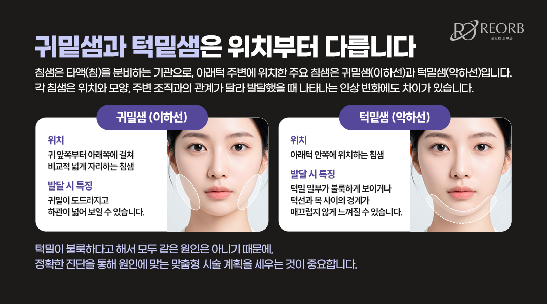 귀밑샘과 턱밑샘의 차이점에 대해 설명한 이미지