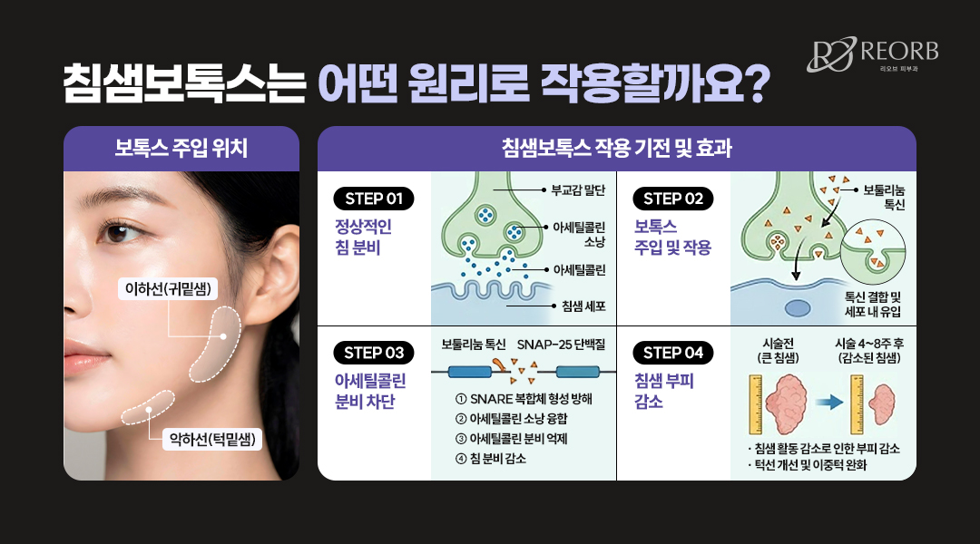 침샘보톡스 원리에 대해 설명한 이미지