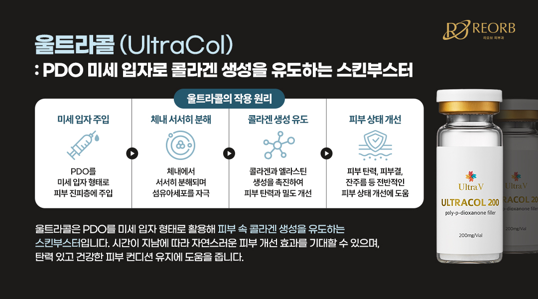 울트라콜 특징에 대해 설명한 이미지