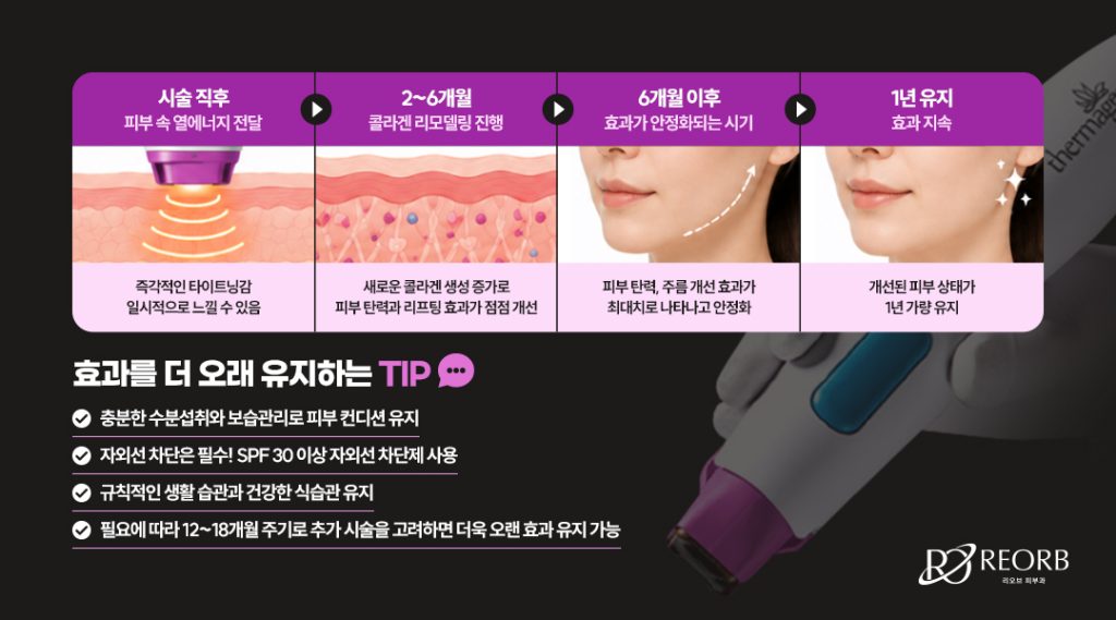 써마지리프팅 효과 오래 유지하고 싶다면?