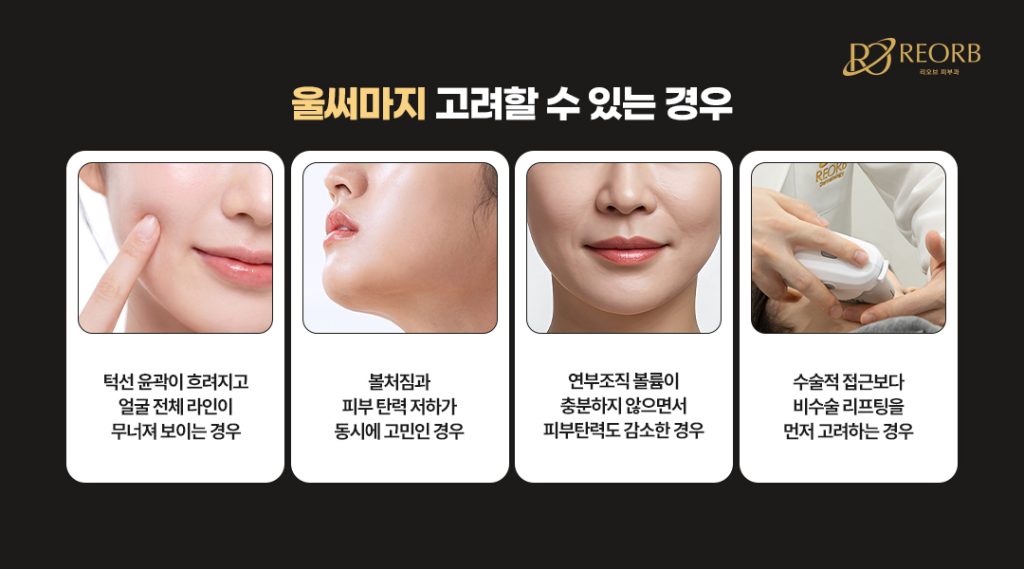 울써마지 추천대상