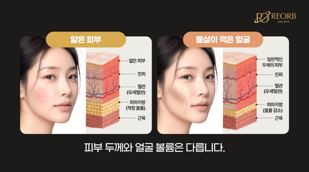얇은 피부 VS 볼살이 적은 얼굴