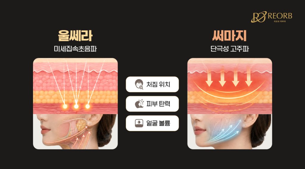 얇은 피부 울쎄라 VS 써마지
