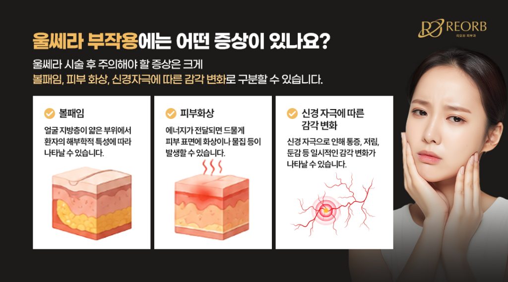 울쎄라부쟉용 증상