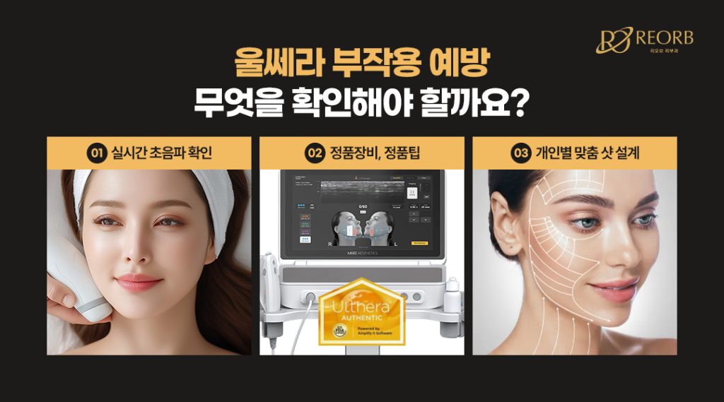 울쎄라 부작용 예방 방법