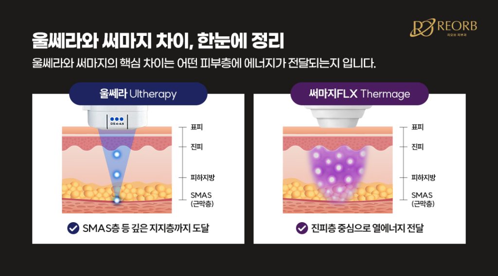 울쎄라 vs 써마지리프팅 차이