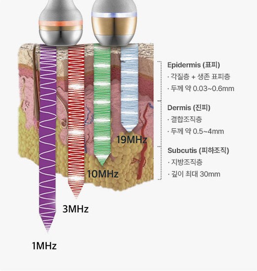 1MHz·3MHz·10MHz 초음파가 표피(Epidermis: 각질층+생존 표피층, 두께 약 0.03~0.6mm), 진피(Dermis: 결합조직층, 두께 약 0.5~4mm), 피하조직(Subcutis: 지방조직층, 깊이 최대 30mm)까지 각각 다른 깊이로 전달되는 모식도