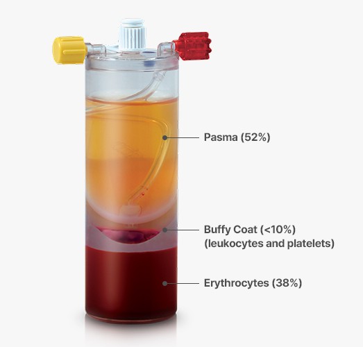 원심분리 후 혈액 성분이 층으로 나뉜 키트: Pasma (52%), Buffy Coat (<10%) (leukocytes and platelets), Erythrocytes (38%)